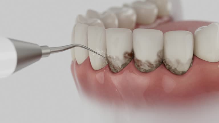 Reliable Emergency Dentist contractor in Pine Air, FL by Smile Center Dentistry
